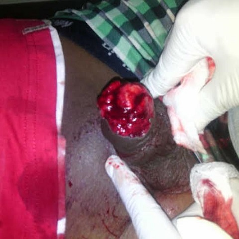 Photos: Girl Bites Off the Penis of Rapist in Lagos (Viewers Discretion